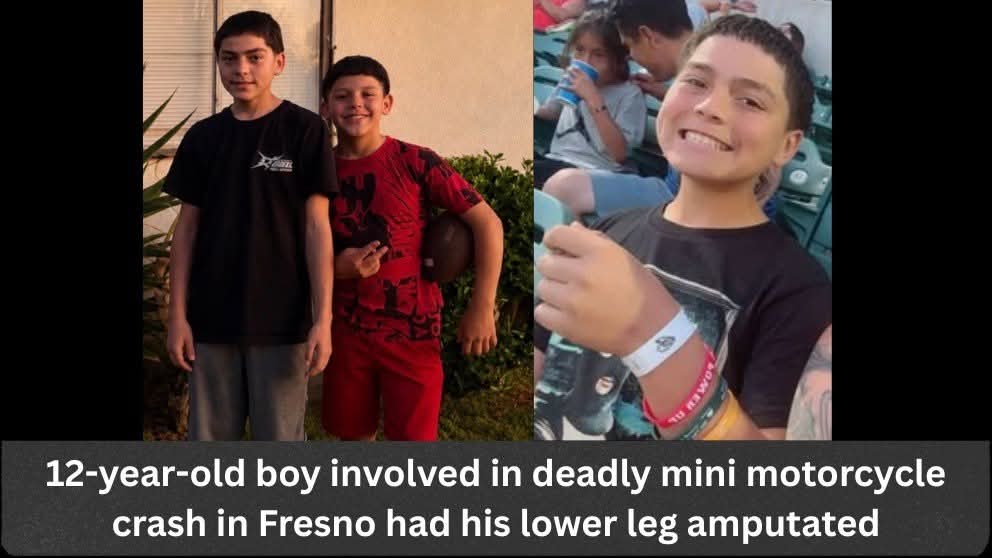 Dominiq Giovani Puentes Killed in Fresno Mini Motorcycle Crash: 12-Year-Old Cousin Undergoes Leg Amputation After Bullard and Palm Collision.